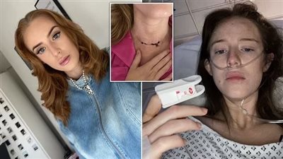 الديجافو وتغيرات حاسة التذوق.. فتاة بريطانية تبلغ عن أعراض غير شائعة لسرطان المخ