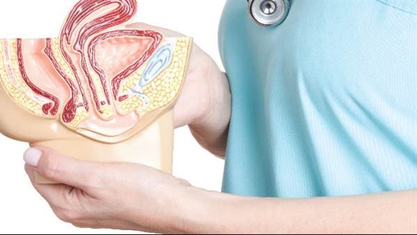 علاج نزول الرحم في