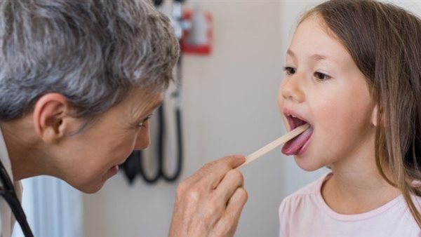 استئصال اللوزتين