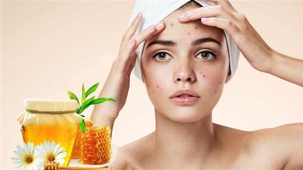 علاج حب الشباب للبشرة