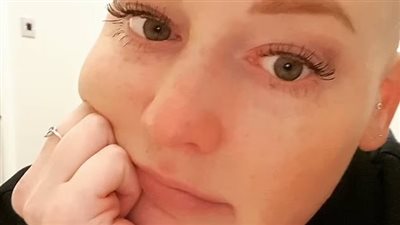 مريضة سرطان تتوقف عن العلاج: سأبني ذكريات مع ابنتي بدلًا من آثار الكيماوي الجانبية