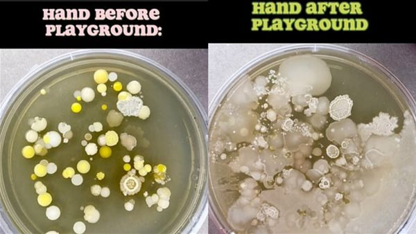 اليد قبل وبعد اللعب