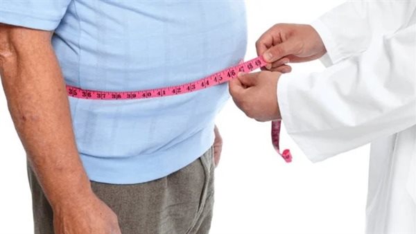 السمنةـ أرشيفية 