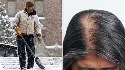 خبراء يحذرون: الطقس البارد يجلب الضرر بشكل غير متوقع مثل تساقط الشعر