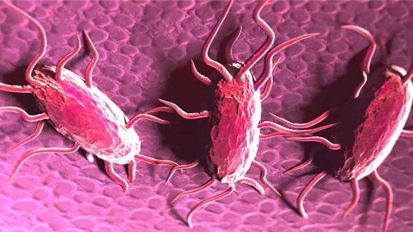 السالمونيلا