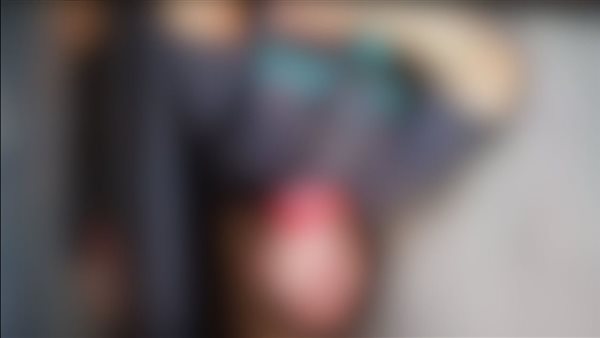 أحد المصابين