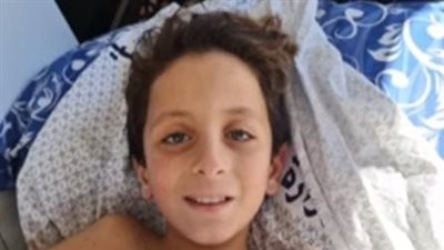 الصحة تعلن إجراء تدخل عاجل لتجنب بتر قدمي الطفل الفلسطيني عبد الله كحيل