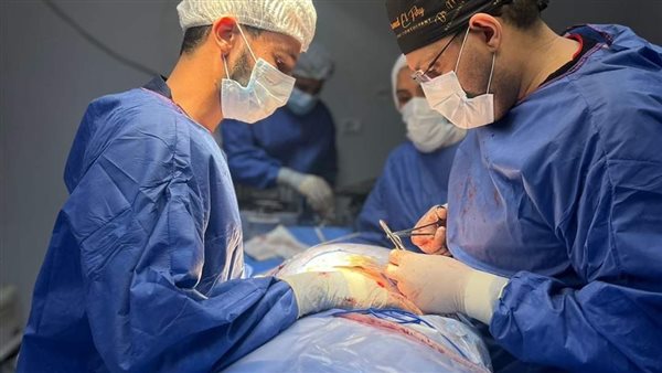 فريق جراحي بالمنوفية