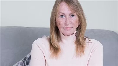 معاناة مروعة.. امرأة تحصل على مليون جنيه إسترليني تعويضًا عن جراحة غير ضرورية