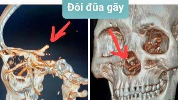 الأشعة المقطعية للرجل