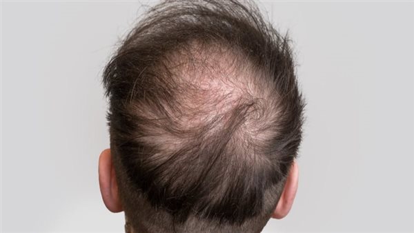 صورة تعبيرية