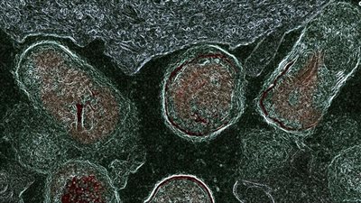 بعد كشفهم عن سبب الإصابة.. خبراء يبتكرون علاجًا للسيطرة على العدوى المهبلية