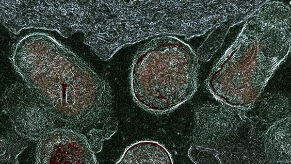 العدوى المهبلية