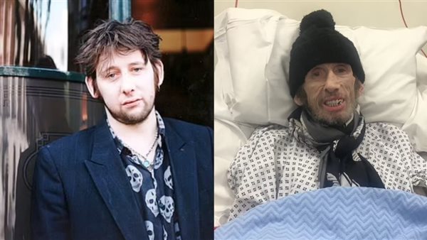 التهاب الدماغ الفيروسي