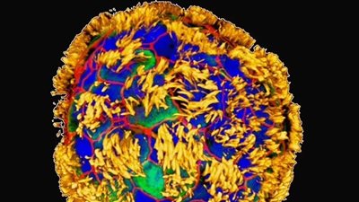 علماء يبتكرون روبوتات مجهرية من خلايا بشرية تعمل على إصلاح الأنسجة المريضة | دراسة