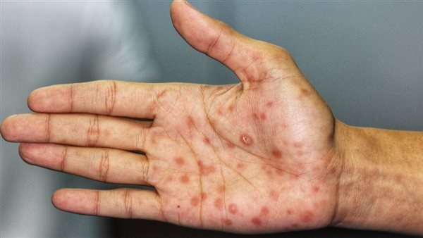 صورة تعبيرية