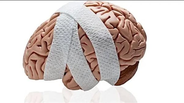 إصابات الدماغ 