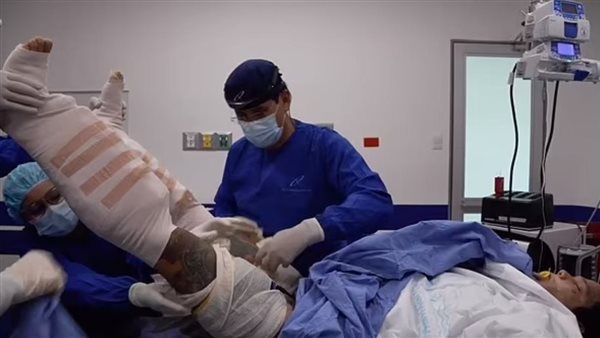 عملية تطويل الساق