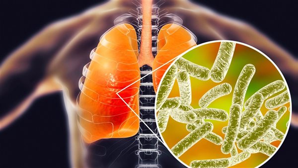 داء الفيالقة