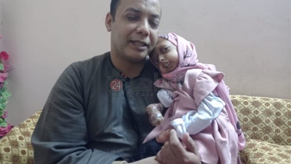 الطفلة آلاء 