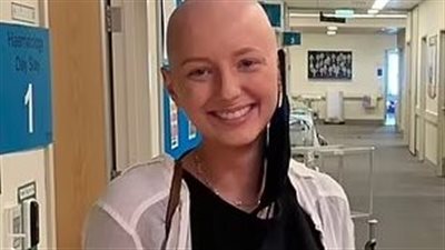 يصيب الطحال والكبد والعظام..عارضة أزياء تصاب بأشد أنواع السرطان بعد معاناتها من آثار الكحول الشديدة