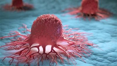 كيف يساهم العلاج الكيميائي في علاج سرطان المثانة؟.. دراسة تكشف