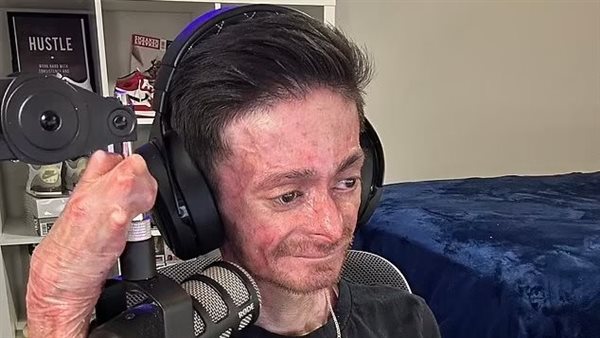  فيكتور هوغو كيروز