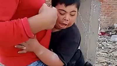 مشاهد صادمة لشباب يعذبون طفلاً من ذوي الهمم بكلب شرس.. ومطالب بالقبض عليهم (صور وفيديو)