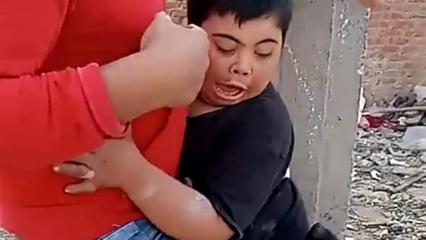 تعذيب طفل من ذوي