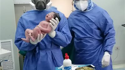 حالة الولادة الثانية لمصابة بفيروس كورونا المستجد في مستشفيات الصحة اليوم