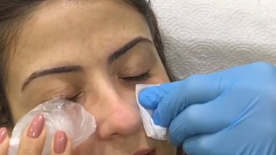 هيدي كرم تخضع لعملية تجميل: “أنا مغرم بنتائج العلاج” (فيديو)