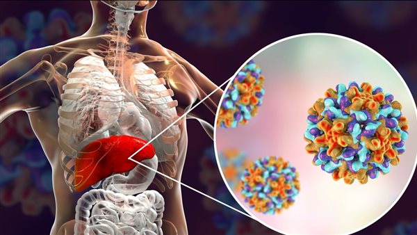 التهاب الكبد 