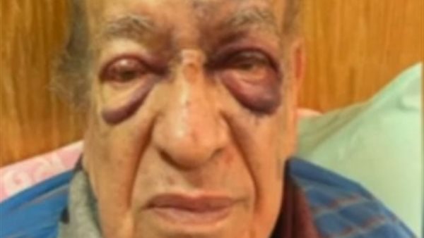 وسيم السيسى