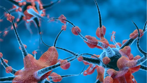 الاضطرابات العصبية