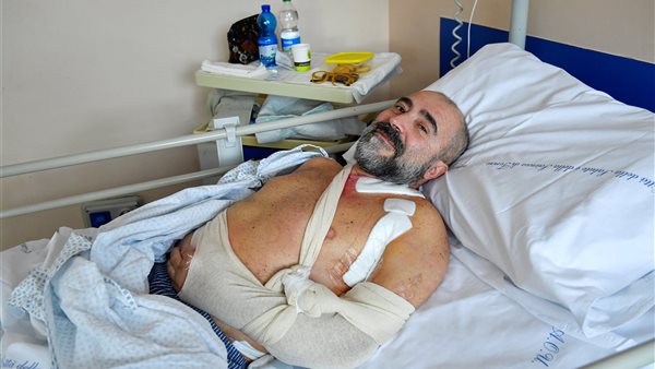 المريض مارسيلو جافيليو