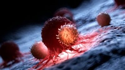 5 عادات صحية يومية للحد من خطر الإصابة بالسرطان