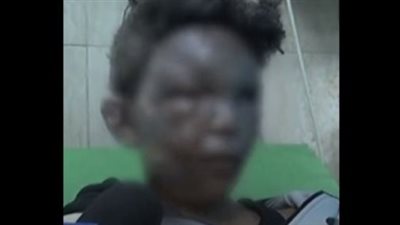 مصدر طبي لـ القاهرة 24: نقل الطفل الفلسطيني صاحب واقعة الشناوي إلى المستشفى الإندونيسي برفح