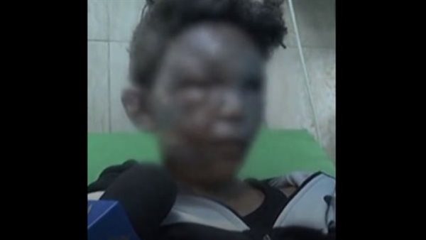 علي طفل غزة 