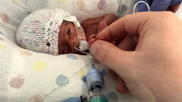 الطفلة لورين