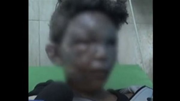 الطفل الفلسطيني علي