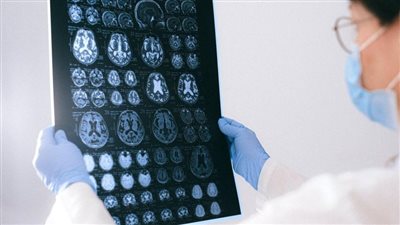 الصعق الكهربائي للدماغ يزيد من القابلية للعلاج بالتنويم المغناطيسي | دراسة