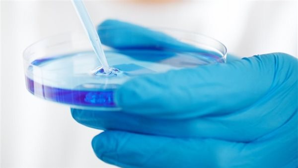 صورة تعبيرية 