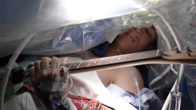 موسيقى في غرفة العمليات.. مغني يعزف على الجيتار خلال خضوعه لجراحة إزالة ورم بالمخ