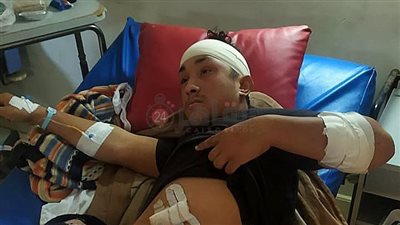 كسر بالجمجمة ونزيف بالمخ والبطن.. اعتداء شخصين بالأسلحة البيضاء على شاب بالغربية 