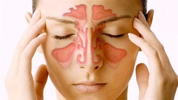 التهابات الجيوب الانفية