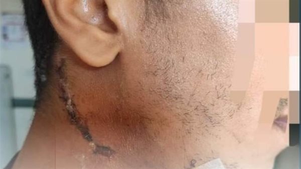 الشاب المصاب بعد