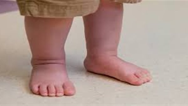 قصر أحد الطرفين السفليين