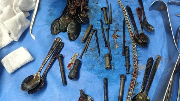 استخراج سلاسل ومعالق