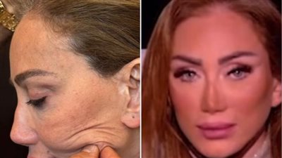 فيه دكتور يسرب صوت مريضة؟.. ريهام سعيد تهاجم طبيب لبنان: شوّهني وأقسم بالله حقي راجع
