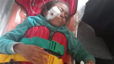 في استجابة سريعة لمحافظ أسوان.. توفير الرعاية الطبية لطفلة سقط عليها أحد أعمدة الإنارة